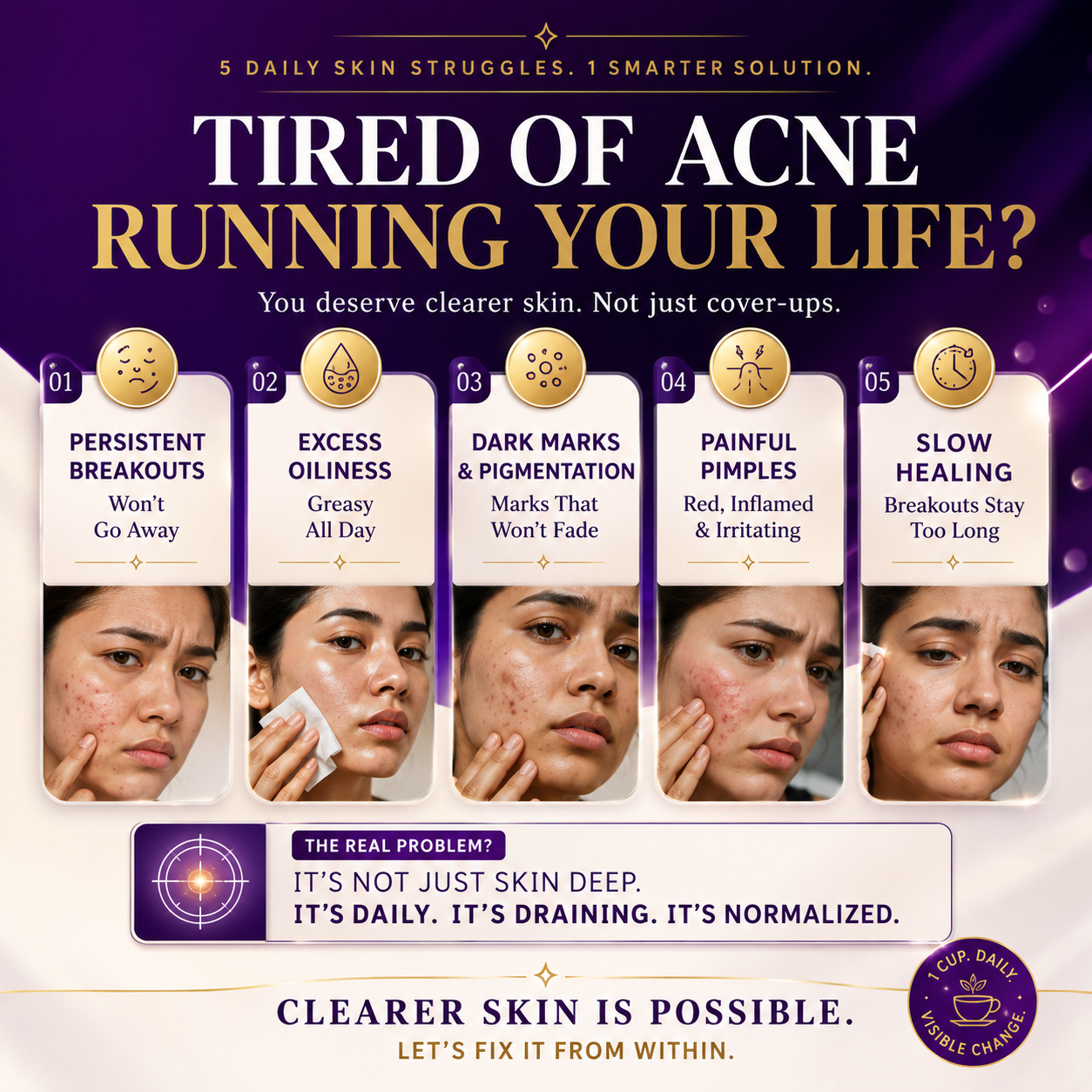 Clarielle Acne Control Supertea