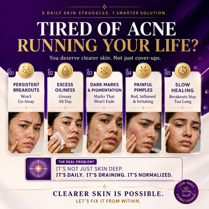 Clarielle Acne Control Supertea