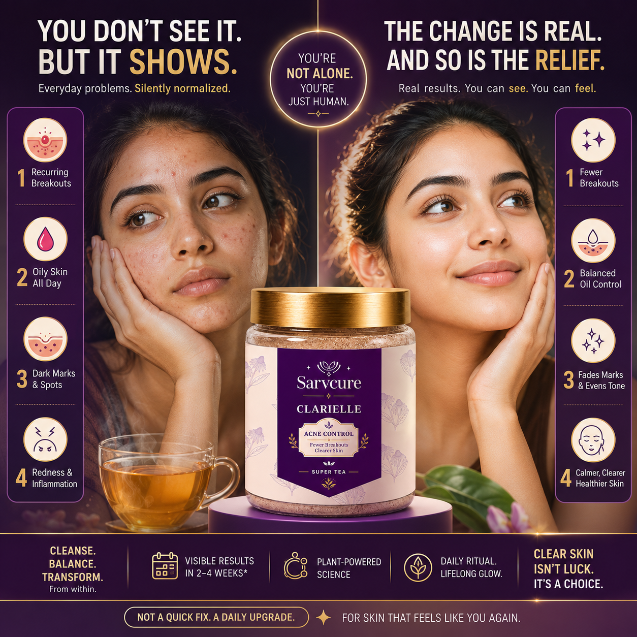 Clarielle Acne Control Supertea