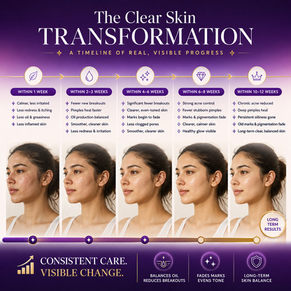 Clarielle Acne Control Supertea