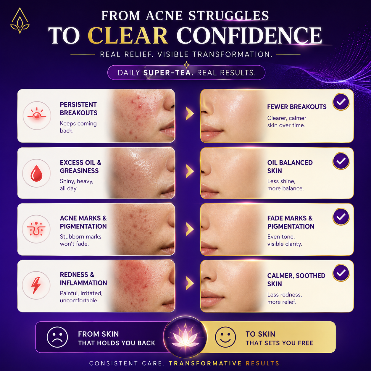 Clarielle Acne Control Supertea