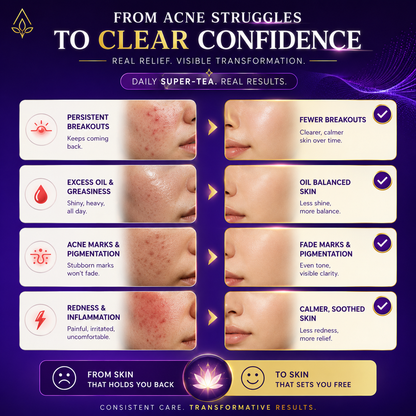 Clarielle Acne Control Supertea
